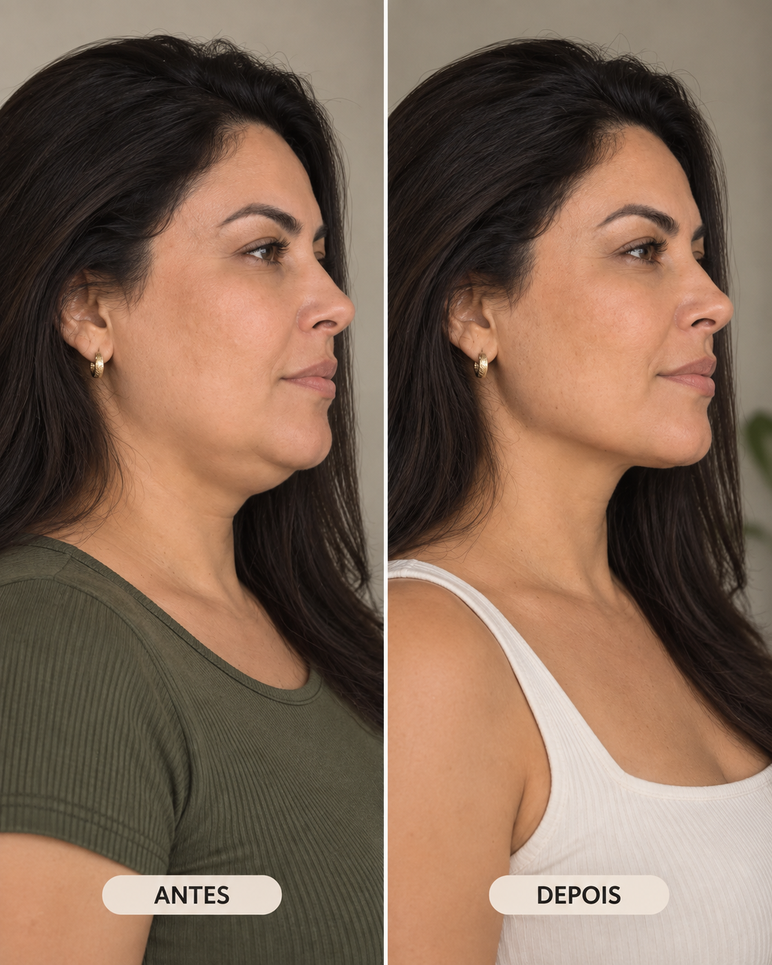 Exemplo ilustrativo de antes e depois do cuidado com o contorno facial