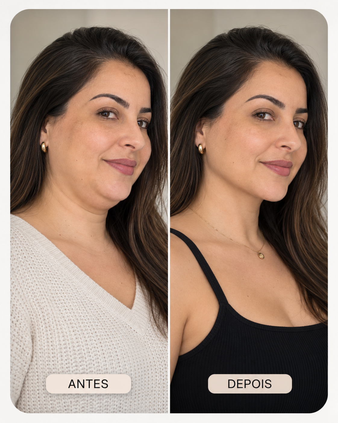 Exemplo ilustrativo de antes e depois do cuidado com o contorno facial